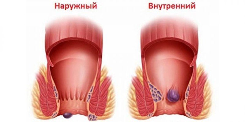 СОВРЕМЕННЫЕ ТЕХНОЛОГИИ В ЛЕЧЕНИИ ...